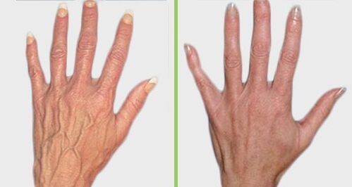 Comparação antes e depois do tratamento