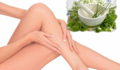 Tratamento de varizes veias das extremidades inferiores com remédios folclóricos