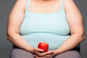 Para curar varizes, você precisa perder o excesso de peso